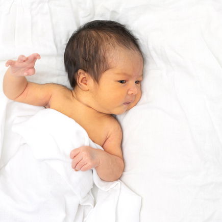 Gelbsucht kommt bei über der Hälfte aller Babys vor!
