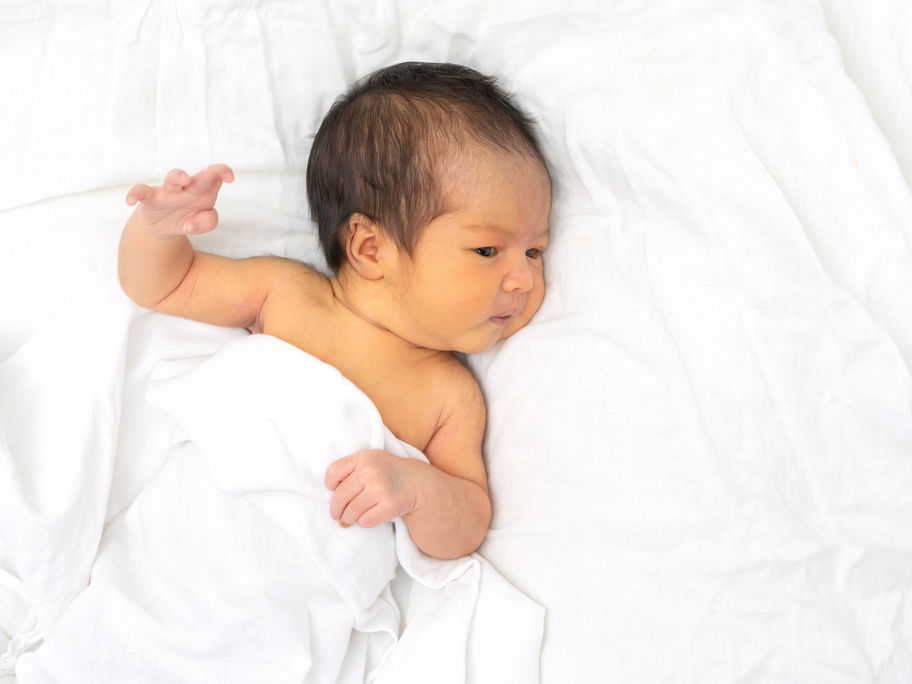 Baby mit Gelbsucht.