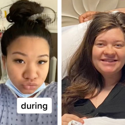 Verrücktes Phänomen: Frauen teilen auf TikTok ihre Schwangerschaftsnasen
