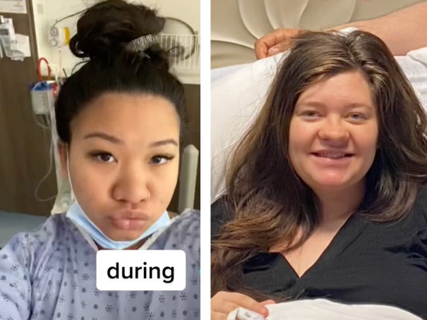 Zwei Frauen zeigen auf TikTok ihre Schwangerschaftsnase.