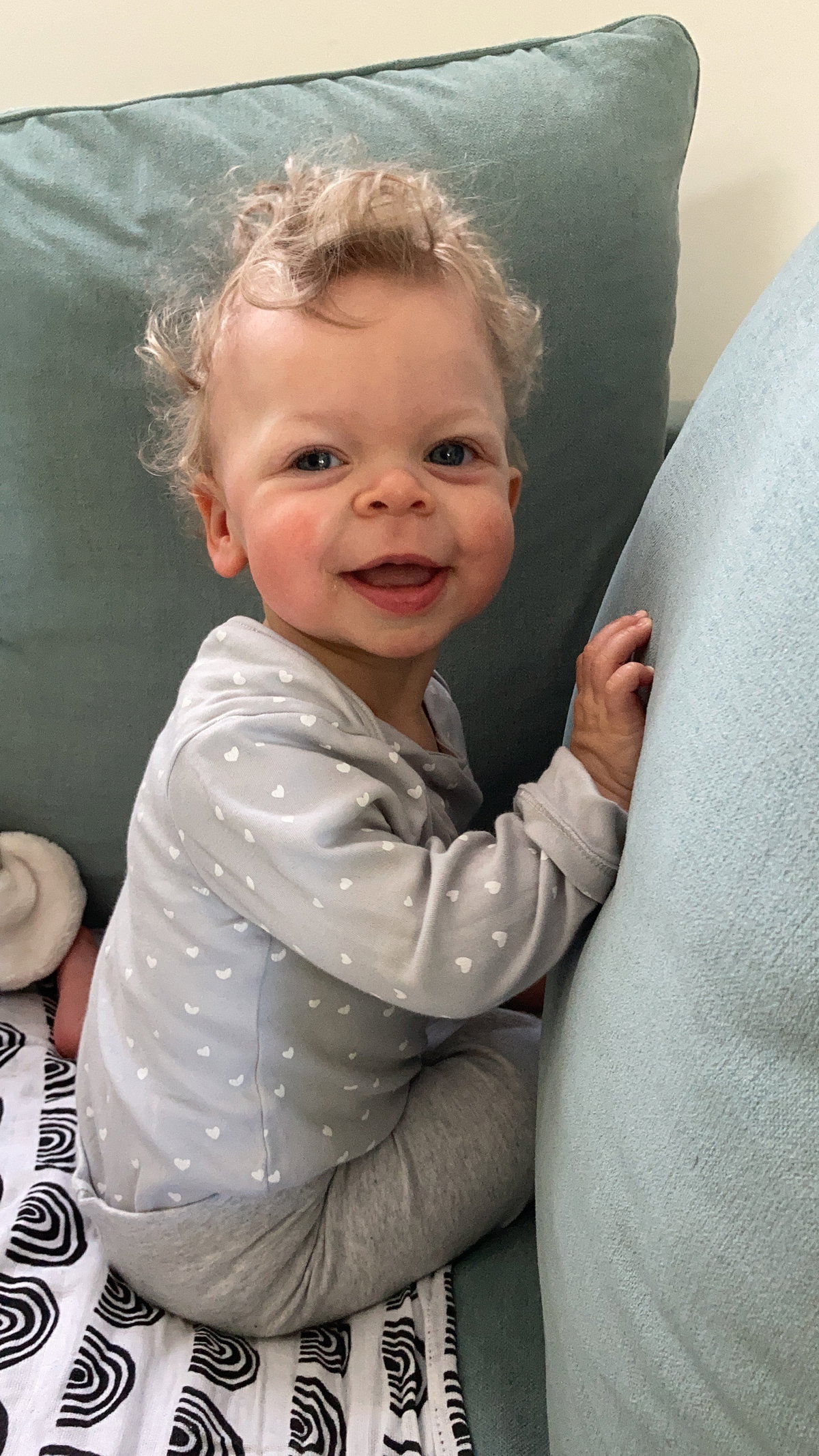 Greta als Baby – sie hat das Williams-Beuren-Syndrom