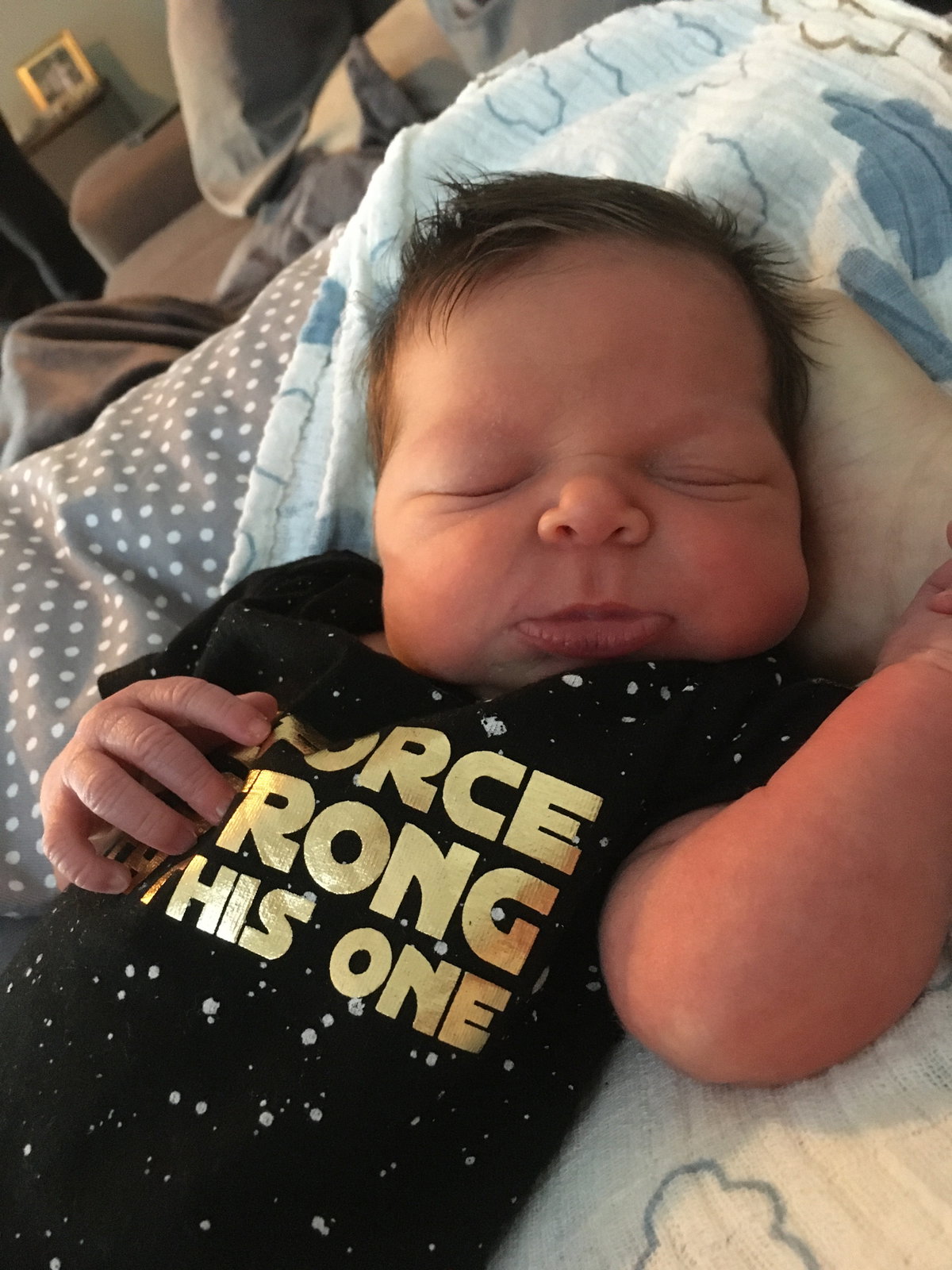 Greta als Baby – sie hat das Williams-Beuren-Syndrom