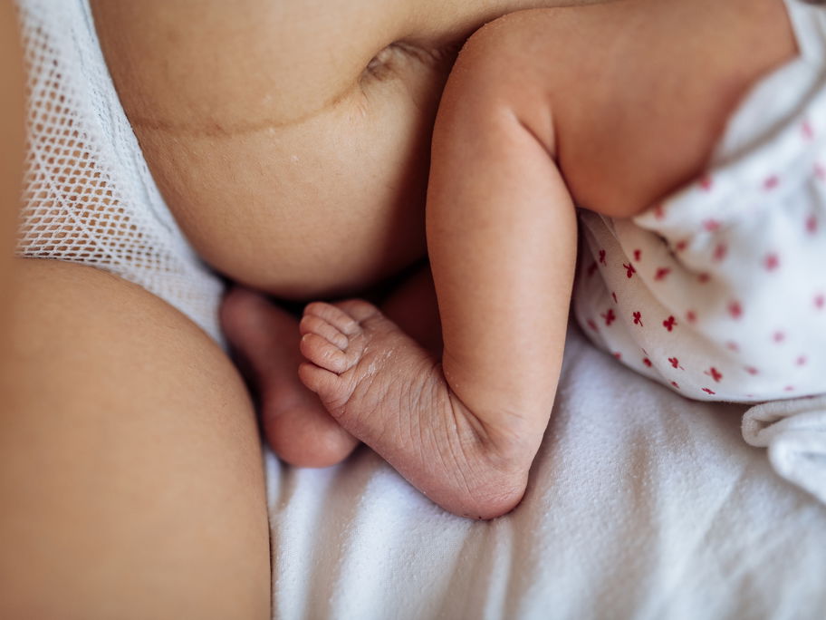 Bauch einer Mutter nach der Geburt mit Baby