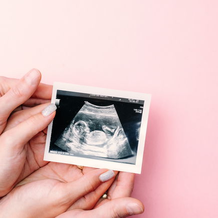 Warum die meisten Eltern lieber ein Mädchen wollen