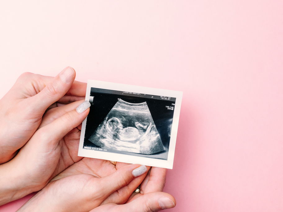 Frauenhände, die Ultraschallbild auf rosa Hintergrund halten.