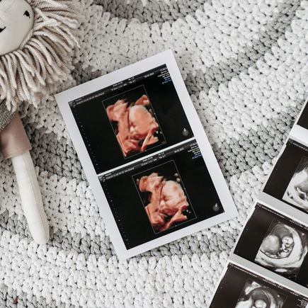 Ultraschallbilder aufbewahren: 7 Ideen, damit die wertvollen Erinnerungen nicht verblassen