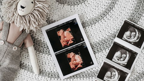 Ultraschallbilder aufbewahren: 7 Ideen, damit die wertvollen Erinnerungen nicht verblassen