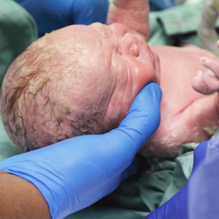 Verhängnisvoller Ärztefehler: "Mein Baby wurde beim Kaiserschnitt vom Skalpell verletzt"