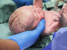 Verhängnisvoller Ärztefehler: "Mein Baby wurde beim Kaiserschnitt vom Skalpell verletzt"