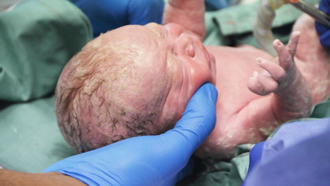 Verhängnisvoller Ärztefehler: "Mein Baby wurde beim Kaiserschnitt vom Skalpell verletzt"