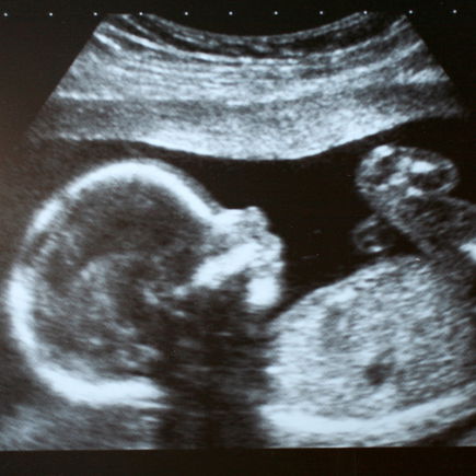 15 erstaunliche Dinge, die dein Baby schon im Bauch kann