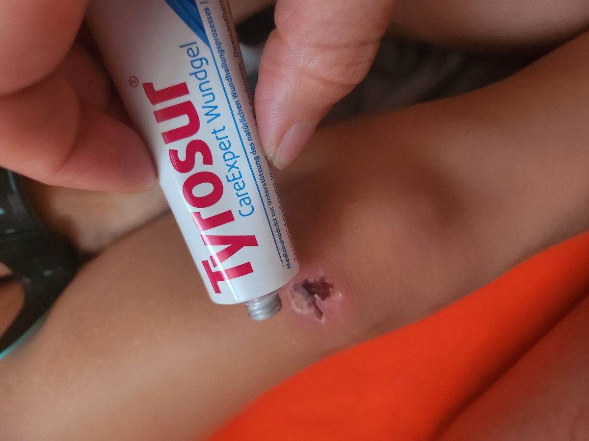 Das "CareExpert Wundgel" sollte in keiner Hausapotheke fehlen.