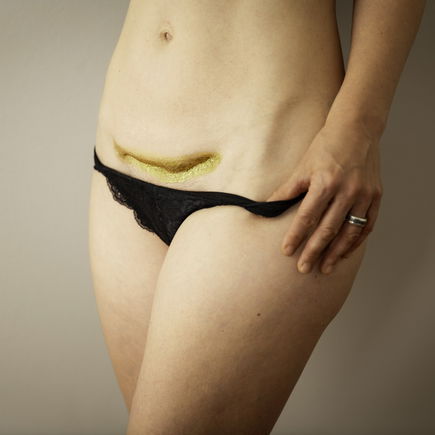 Fotografin vergoldet Kaiserschnittnarben: "Ich will diesen Frauen zeigen, wie schön und vollkommen sie sind!"