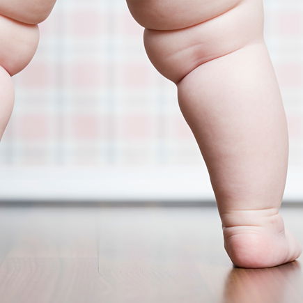 Dickes Baby: Ab wann ist Babyspeck nicht mehr niedlich?