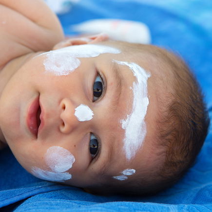 Hitzepickel oder Sonnenallergie? So unterscheidest du den Sommer-Ausschlag bei deinem Baby