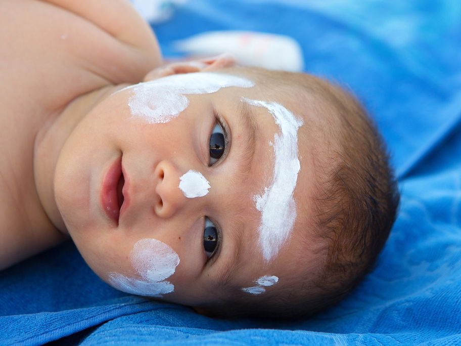 Babys und Kleinkinder sind besonders anfällig für Hitzepickel. Je heller der Hauttyp desto eher.