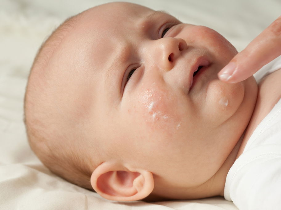 Baby bekommt das Gesicht eingecremt.