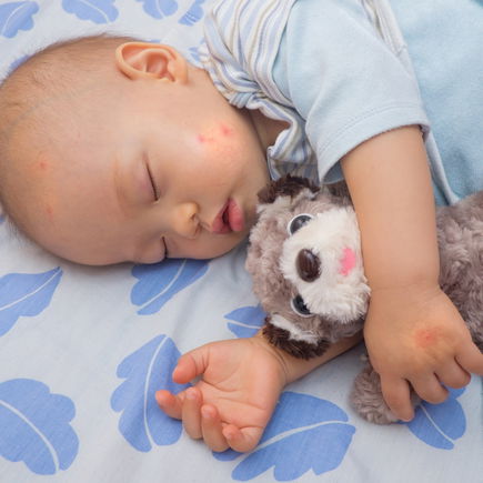 Sicher durch den Sommer: Der beste Mückenschutz für Babys und Kleinkinder
