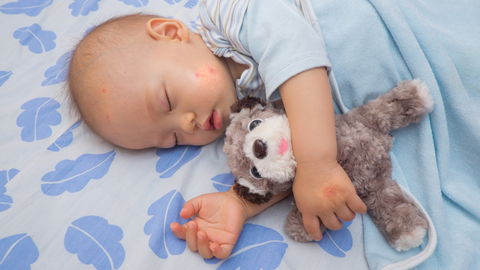 Sicher durch den Sommer: Der beste Mückenschutz für Babys und Kleinkinder
