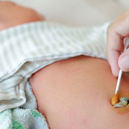 Babys Nabelschnur: Alle Infos zum Durchtrennen, Aufbewahren und Co.