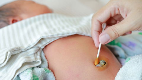 Babys Nabelschnur: Alle Infos zum Durchtrennen, Aufbewahren und Co.