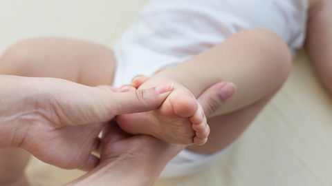 Sichelfuß beim Baby