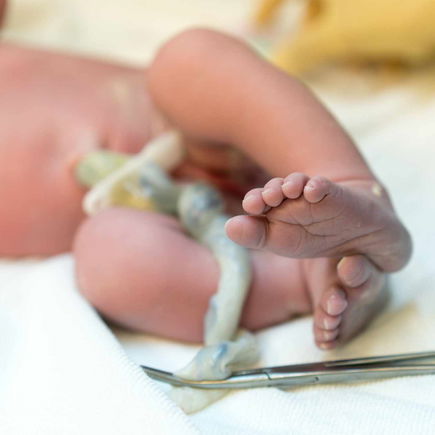"Ewige Chemikalien" im Nabelschnurblut von 30.000 Babys gefunden