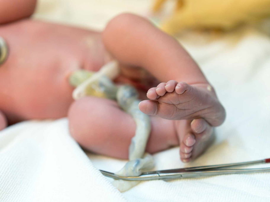 Studien ergaben: Schon bei der Geburt befinden sich die "ewigen Chemikalien" im Nabelschnurblut von Babys.