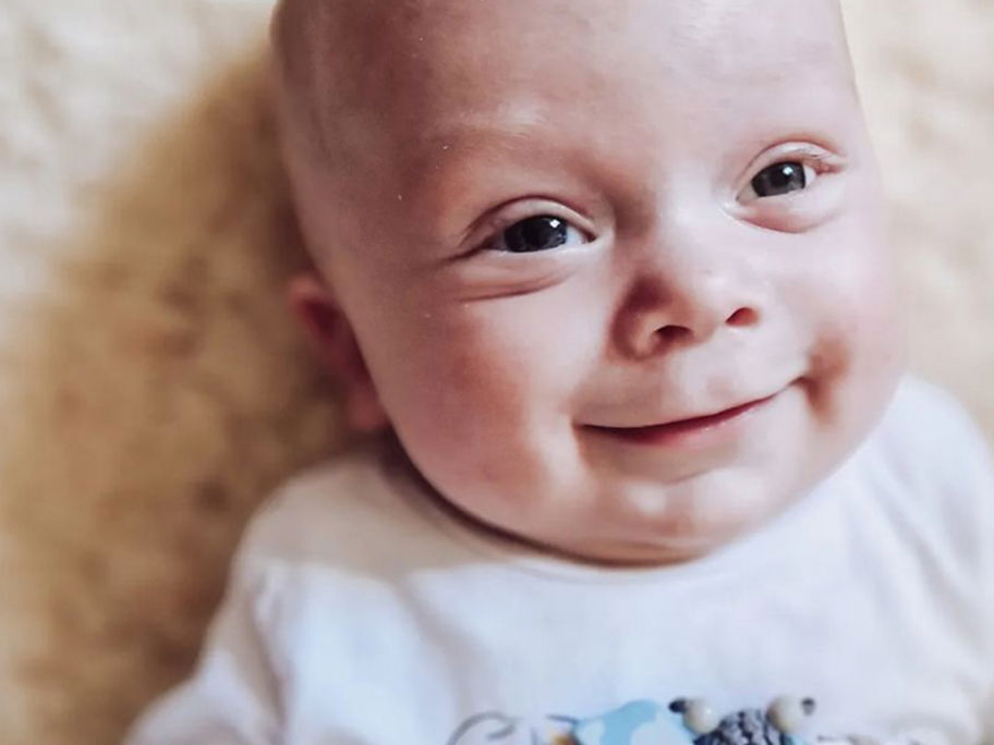 Ein kleines Baby mit Glasauge.