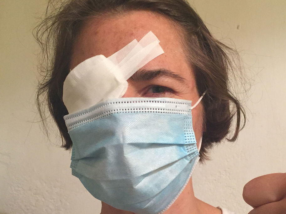 Ein kleiner Unfall ist im Alltag schnell passiert. Hier landete der Kinderfinger im Auge der Mutter.