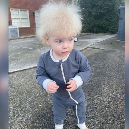 Struwwelpeter-Syndrom: Dieser Junge hat unkämmbare Haare und wird dafür geliebt!