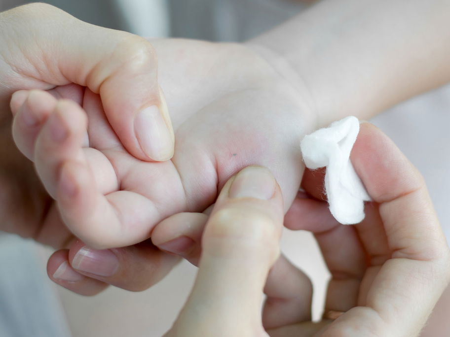 Kinderhand mit Splitter.