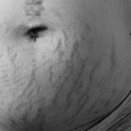 Bäuche-Bilder: Liebe Mamas, ihr seid schön!