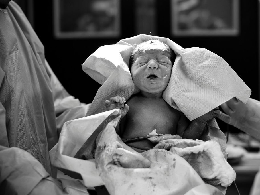 Es wird heiß diskutiert: Schadet Cytotec bei der Geburtseinleitung dem Baby?