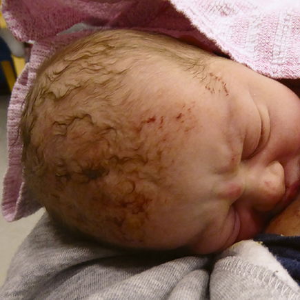 Sophie kam auf der Treppe VOR der Klinik zur Welt: "Geh hinter mich und fang das Baby auf!"