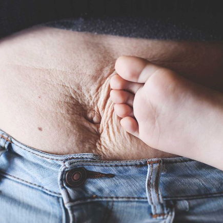 Mama verfasst eine Liebeserklärung an ihren After-Baby-Bauch