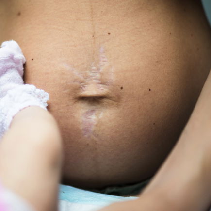 Flacher Bauch nach der Geburt? Ehrlich: Das ist gar nicht möglich!