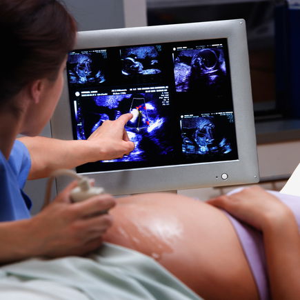 Ist Ultraschall gefährlich fürs Baby?