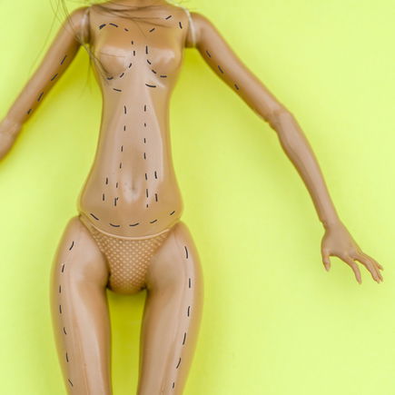 "Mommy Makeover": Warum sich immer mehr Mütter für eine Schönheits-OP entscheiden